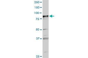PLA2G6 anticorps  (AA 1-752)