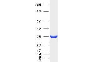 Validation with Western Blot