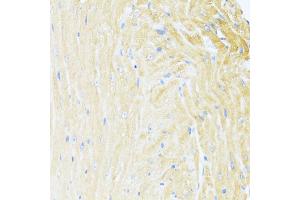 Immunohistochemistry of paraffin-embedded mouse heart using UQCC2 antibody  at dilution of 1:100 (40x lens). (MNF1 anticorps  (AA 14-126))