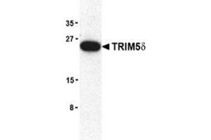 Western blot analysis of TRIM5 delta expression in mouse brain cell lysate with TRAP30953PU-N at 2 μg/ml. (TRIM5 anticorps  (C-Term, Isoform delta))