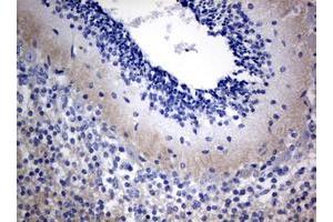 Image no. 1 for anti-Visinin-Like 1 (VSNL1) (AA 2-191) antibody (ABIN1491120)