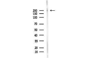 anti-Lysine (K)-Specific Demethylase 3B (KDM3B) (Internal Region) antibody