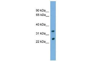 CHMP4B antibody used at 0.