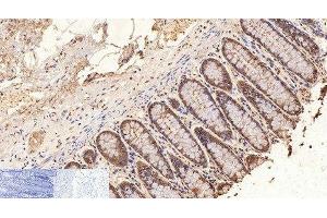 Immunohistochemistry of paraffin-embedded Human colon tissue using GAPDH Monoclonal Antibody at dilution of 1:200.