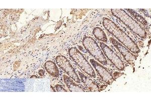 Immunohistochemistry of paraffin-embedded Human colon tissue using GAPDH Monoclonal Antibody at dilution of 1:200. (GAPDH anticorps)