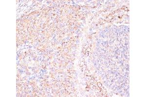 Immunohistochemistry of paraffin-embedded Rat ovary using ATP5A1 Polyclonal Antibody at dilution of 1:100 (40x lens).