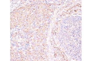 Immunohistochemistry of paraffin-embedded Rat ovary using ATP5A1 Polyclonal Antibody at dilution of 1:100 (40x lens). (ATP5A1 anticorps)