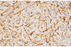 Immunohistochemistry of paraffin-embedded Mouse liver using FGB Polycloanl Antibody at dilution of 1:200