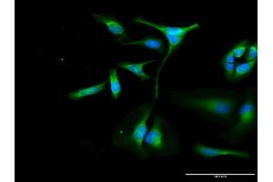 Immunofluorescence of purified MaxPab antibody to OXA1L on HeLa cell. (OXA1L anticorps  (AA 1-435))