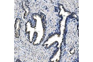 IHC analysis of PCK2 using anti-PCK2 antibody (ABIN7599509). (PEPCK anticorps  (AA 1-640))