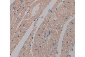 IHC-P analysis of heart tissue, with DAB staining. (NT5C anticorps  (AA 12-200))