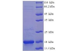 SDS-PAGE (SDS) image for Frataxin (FXN) (AA 81-210) protein (His tag) (ABIN5711503)