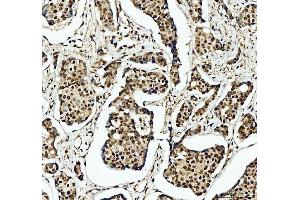 IHC analysis of SFPQ using anti-SFPQ antibody (ABIN7603089). (SFPQ anticorps  (Middle Region))