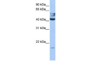 QTRT1 antibody used at 0. (QTRT1 anticorps)