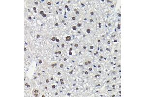 Immunohistochemistry of paraffin-embedded mouse liver using Phospho-ERK1-T202 + ERK2-T185 antibody (ABIN7268610) at dilution of 1:100 (40x lens). (ERK1/2 anticorps  (pThr185, pThr202))
