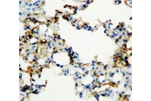 IHC-P: RAGE antibody testing of rat lung tissue (RAGE anticorps  (Middle Region))