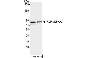 Western Blotting (WB) image for anti-Importin Subunit alpha-1 (KPNA2) (C-Term) antibody (ABIN7453571) (Importin Subunit alpha-1 (KPNA2) (C-Term) anticorps)