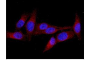 IF analysis of MID1 using anti-MID1 antibody (ABIN6719400). (MID1 anticorps  (AA 226-278))