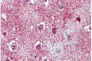 Brain, cortex, Human: Formalin-Fixed, Paraffin-Embedded (FFPE)