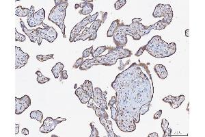 IHC analysis of ATX2/ATXN2 using anti-ATX2/ATXN2 antibody (ABIN3043507). (Ataxin 2 anticorps  (C-Term))