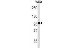Western Blotting (WB) image for anti-Integrin beta 7 (ITGB7) antibody (ABIN2998522) (Integrin beta 7 anticorps)