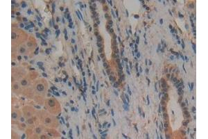 Detection of uPAR in Human Liver Tissue using Polyclonal Antibody to Plasminogen Activator, Urokinase Receptor (uPAR)