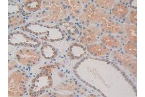IHC-P analysis of Human Kidney Tissue, with DAB staining. (CACYBP anticorps  (AA 2-228))