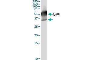 Immunoprecipitation of GALE transfected lysate using anti-GALE MaxPab rabbit polyclonal antibody and Protein A Magnetic Bead , and immunoblotted with GALE MaxPab rabbit polyclonal antibody (D01) . (GALE anticorps  (AA 1-348))