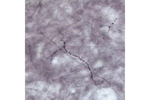 IHC on rat brain (free floating sections) using Rabbit antibody to VGluT1  at a concentration of 30 µg/ml.