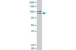PRDM1 monoclonal antibody (M04), clone 2F8 Western Blot analysis of PRDM1 expression in SJCRH30 .