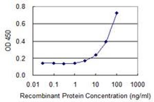 Detection limit for recombinant GST tagged BAZ2B is 0.