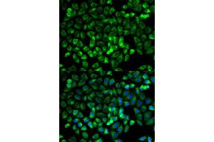 Immunofluorescence (IF) image for anti-Tryptase alpha/beta 1 (TPSAB1) antibody (ABIN1875186) (TPSAB1 anticorps)