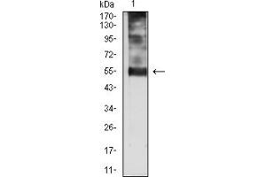 Western blot analysis using CDKN1C mouse mAb against SK-Br-3 (1 cell lysate.