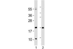 Western blot testing of Hopx antibody at 1:2000 with 1) human heart lysate and 2) mouse heart lysate