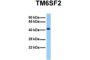 Host:  Rabbit  Target Name:  TM6SF2  Sample Tissue:  Human Fetal Liver  Antibody Dilution:  1. (TM6SF2 anticorps  (C-Term))