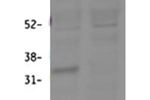 ABIN768641 (0. (HSD11B1 anticorps  (Internal Region))