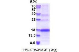 SDS-PAGE (SDS) image for Vascular Endothelial Cell Growth Factor 121 (VEGF121) (Isoform 121) protein (His tag) (ABIN666717) (VEGF121 Protein (Isoform 121) (His tag))