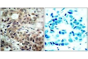 Image no. 1 for anti-Cell Division Cycle 25 Homolog C (S. Pombe) (CDC25C) (pSer216) antibody (ABIN196818) (CDC25C anticorps  (pSer216))