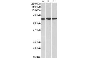 ABIN1590061 (1µg/ml) staining of NIH3T3, (A) A549 (B) and HeLa (C) lysates (35µg protein in RIPA buffer). (MMP14 anticorps  (Internal Region))