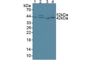 Western blot analysis of (1) Human 293T Cells, (2) Human HeLa cells, (3) Rat Skeletal Muscle Tissue and (4) Human HepG2 Cells. (CS anticorps  (AA 56-312))