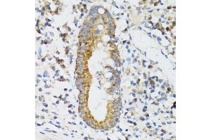 Immunohistochemistry of paraffin-embedded human vermiform appendix using SRP19 antibody (ABIN6129677, ABIN6148450, ABIN6148451 and ABIN6222484) at dilution of 1:100 (40x lens).