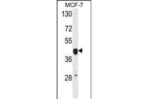 Western blot analysis of ETS2 Antibody in MCF-7 cell line lysates (35ug/lane) (ETS2 anticorps  (AA 146-173))