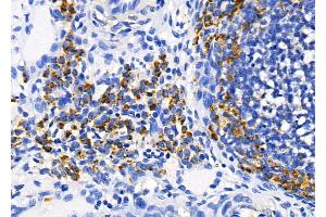 ABIN6259851 and ABIN6278727 at 1/100 staining Rat ovarian tissue by IHC-P. (AKAP12 anticorps  (C-Term))