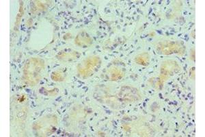 Immunohistochemistry of paraffin-embedded human kidney tissue using ABIN7156941 at dilution of 1:100 (IL-9 anticorps  (AA 19-144))