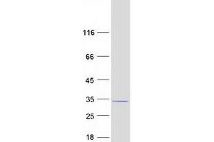 Validation with Western Blot