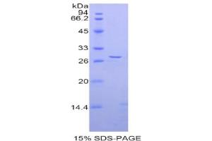 SDS-PAGE analysis of Rat ADAM5 Protein. (ADAM5 Protéine)