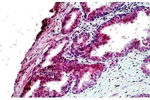 Human Prostate: Formalin-Fixed, Paraffin-Embedded (FFPE) (TBC1D10A anticorps  (AA 2-14))