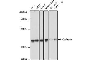 Western blot analysis of extracts of various cell lines, using E-Cadherin antibody  at 1:1000 dilution.