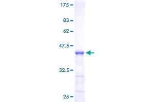 Image no. 1 for Numb Homolog (NUMB) (AA 1-135) protein (GST tag) (ABIN1313212)