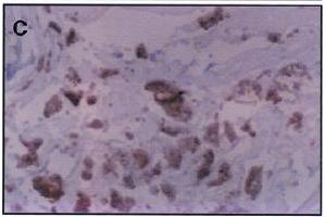 Immunohistochemistry image of dihydropyridine adduct staining in paraffn section of human atherosclerotic aorta.